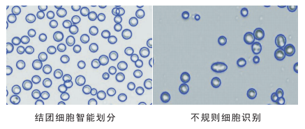 细胞计数仪细胞划分图片 细胞计数仪细胞划分图片